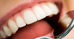 むし歯や歯周病のリスクを軽減