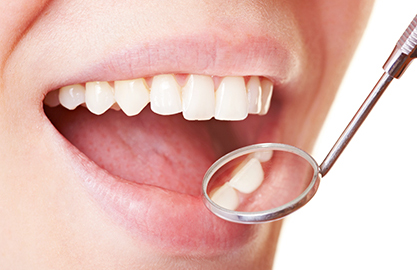 噛み合わせのチェック